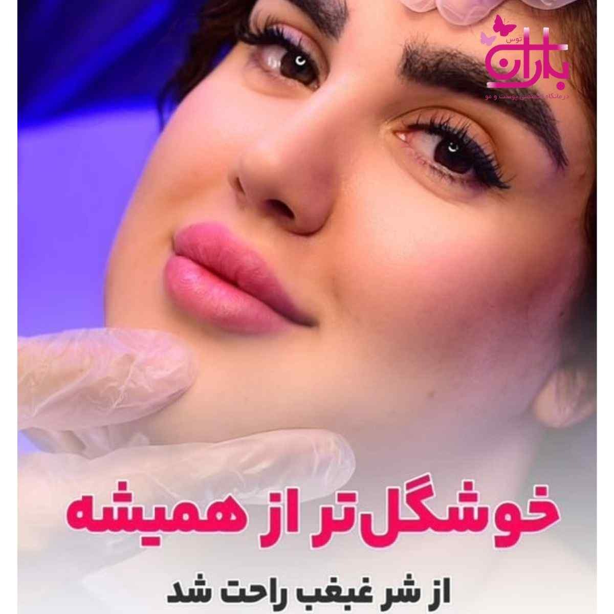 آیا می‌شود با کاهش وزن غبغب را کوچک کرد یا حتماً باید ساکشن غبغب انجام داد؟